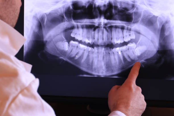 Best Knocked-Out Tooth Emergency  in Ferguson, MO