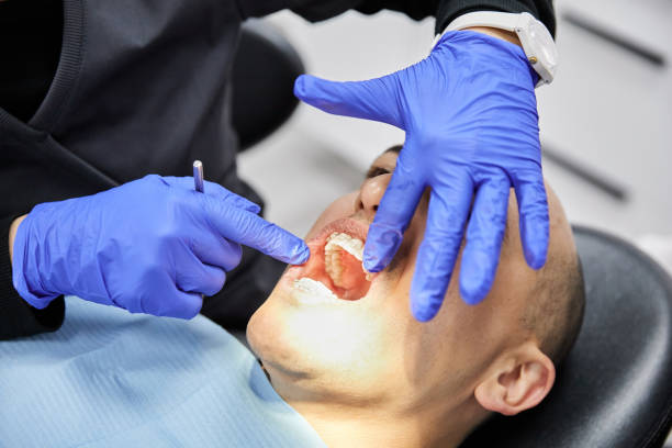 Best Tooth Infection Emergency Dentist  in Ferguson, MO