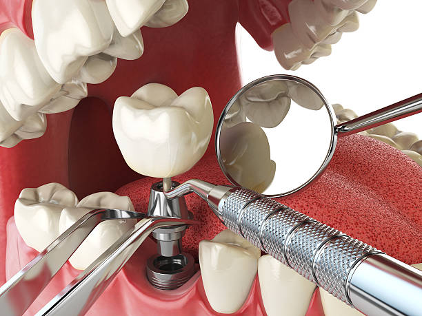 Dentist for Dental Trauma in MO